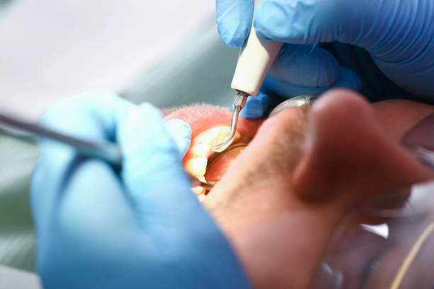 Best Emergency Denture Repair in Long Beach, IN
